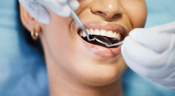 Best Dental Abscess Treatment in Bloomington, TX