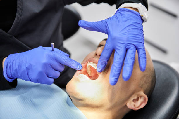 Best Emergency Dental Care for Sports Injuries in Bloomington, TX